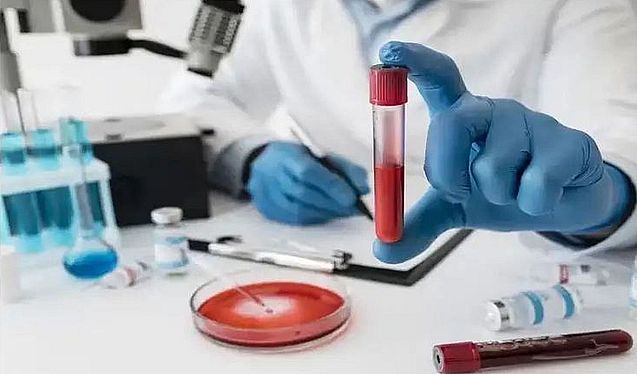 दक्षिण कन्नड़ जिले के 5063 बच्चों में पाई एनीमिया की समस्या